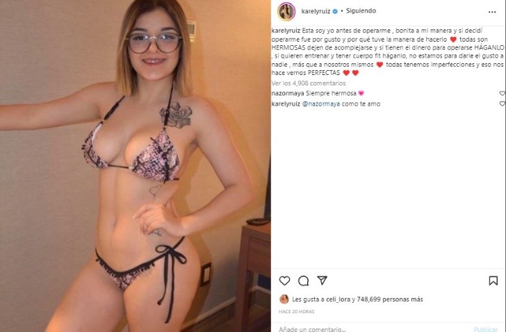 Karely Ruiz showed a photo of what it was like before surgery and left her speechless